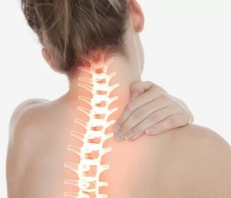 Cervikálna osteochondróza